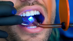 Юридические аспекты и реальные сроки гарантии на стоматологические услуги